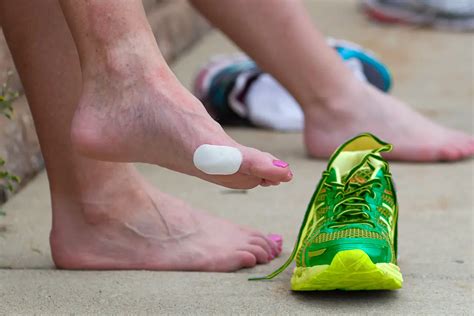 Blisters When Running: A Symphony of Pain and Perseverance