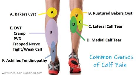 Calf Muscle Pain When Running: Exploring the Unseen Connections